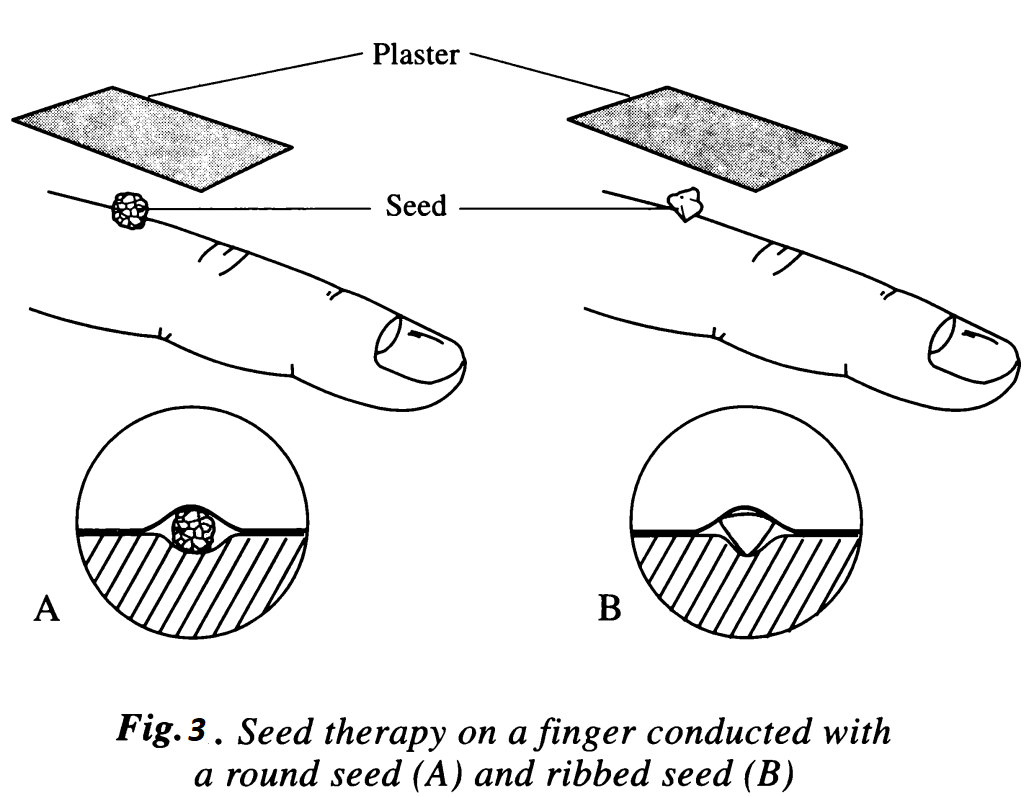 seeds therapy