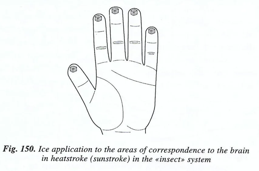 sujok therapy for high bp