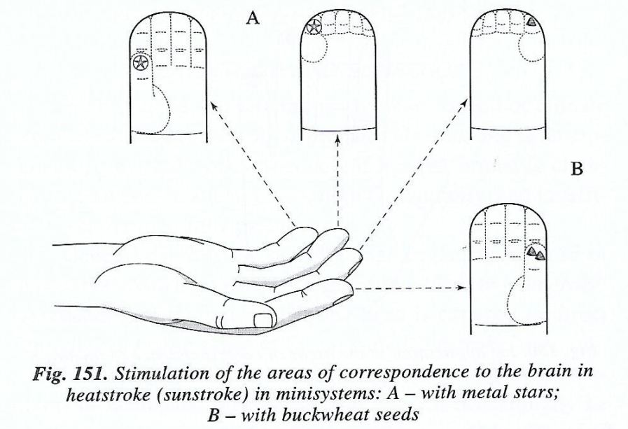 sujok therapy for high bp