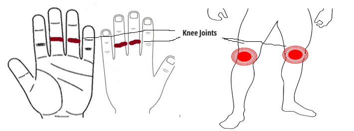 sujok therapy for knee pain